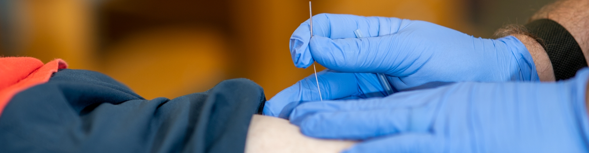 Dry Needling