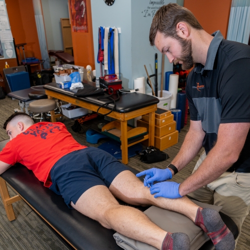 Dry-Needling-Total-Motion-Physical-Therapy-Radford-Christianburg-Blacksburg-VA